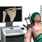 Minimally Invasive Shoulder Joint Replacement