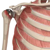Revision Shoulder Replacement
