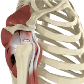 Rotator Cuff Re-tear