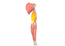 Triceps Tendonitis