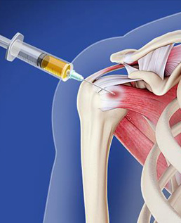 Bone Marrow Aspirate Concentrate (BMAC) Therapy for Rotator Cuff Injuries