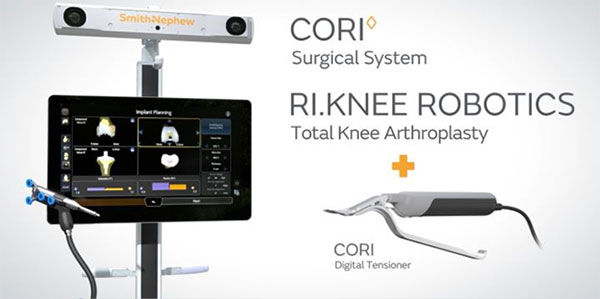 Outpatient Robotic Knee Replacement