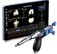 Outpatient Robotic Knee Replacement