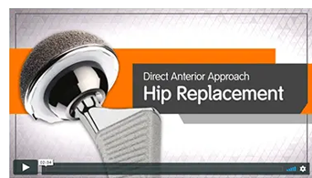 Direct Anterior Total Hip Replacement