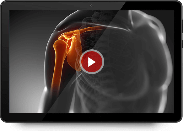 arthroscopic-surgery