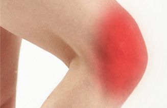 knee pain