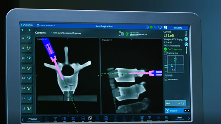 Mazor X Stealth Edition  – Clip 4