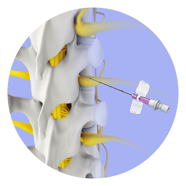 Non-Operative Treatments