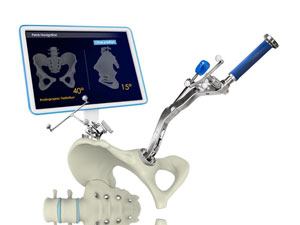 Anterior Hip Replacement with Navigation pic