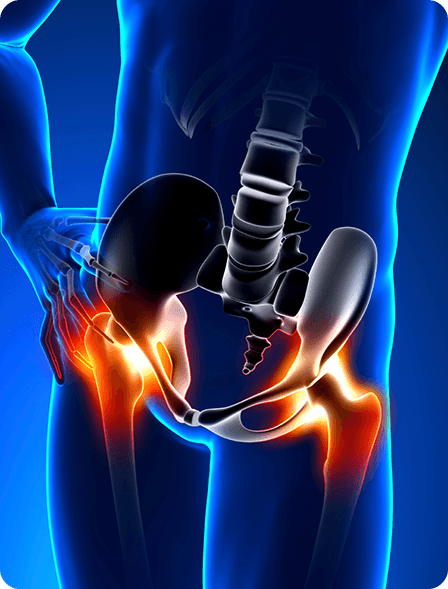 Hip Pain