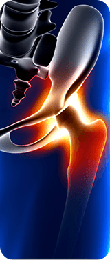 Hip Pain & Trauma