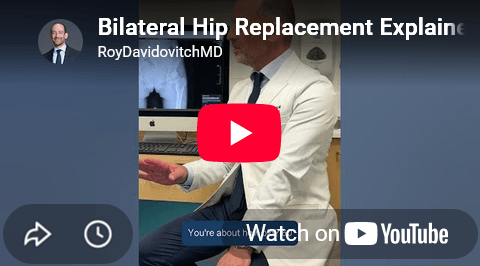 A case of bilateral hip arthritis