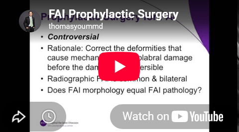 FAI Prophylactic Surgery