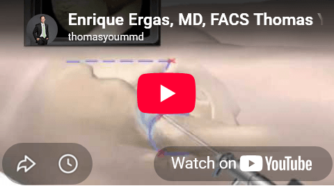 Enrique Ergas, MD, FACS Thomas Youm, MD, FACS Hip Arthroscopy Hip Arthroscopy