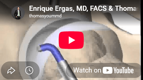 Enrique Ergas, MD, FACS Thomas Youm, MD, FACS Hip Arthroscopy