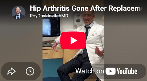 Young patient needing hip replacement now fully recovered