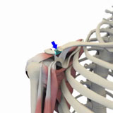 distal-clavicle-excision