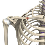 nonunion-fixation-of-a-shoulder
