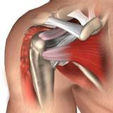 proximal-biceps-tenodesis