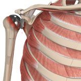 revision-shoulder-replacement