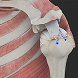 rotator-cuff-repair