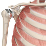 shoulder-joint-replacement