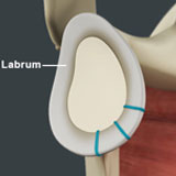 shoulder-labrum-reconstruction