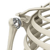 shoulder-resurfacing