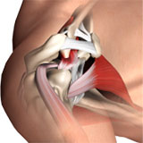subacromial-decompression