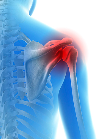 Baseball Shoulder Injuries