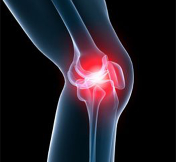 Knee Pain