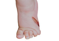 Acute Pediatric Injuries