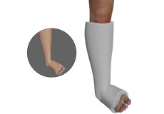 Clubfoot Casting and Surgery