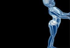 Spondyloepiphyseal Dysplasia