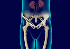 X-Linked Hypophosphatemia Rickets (XLH)