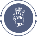 Hypochondroplasia / Achondroplasia