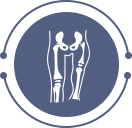 Congenital Femoral Deficiency