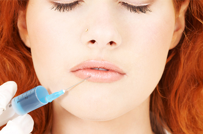 Lip Augmentation
