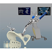 Computer-Navigated Total Hip Replacement