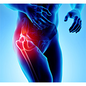 Hip Pain