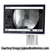 Velys Hip Navigation