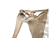 Acromioclavicular Joint Sprains