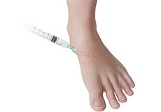 Foot Injections