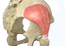 Hip Adductor Injuries