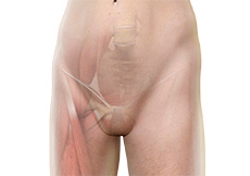 Hip and Groin Disorders