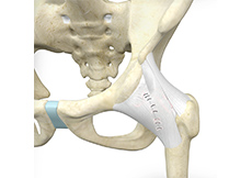 Hip Capsular Closure