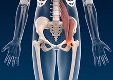 Iliopsoas Tendon Lengthening
