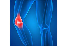 Knee Injury