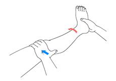 Nonoperative Treatments for ACL Injuries