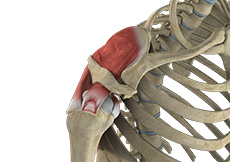 Partial Rotator Cuff Tear